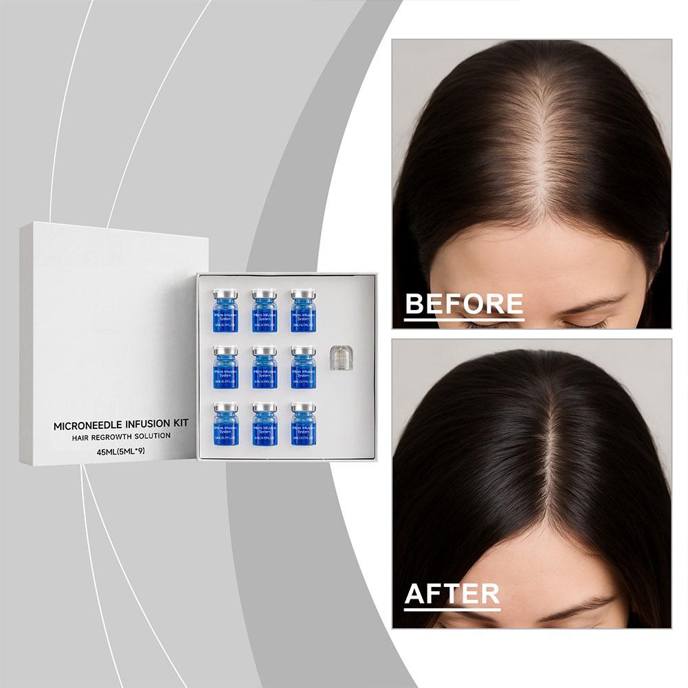 Hair Care Oil Serum - Kit de Rolo de Microagulhas com