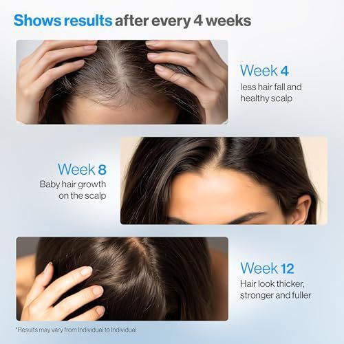 Sérum Premium de Alecrim Anti- - Hair Care For Hair Fall avaliação e preço