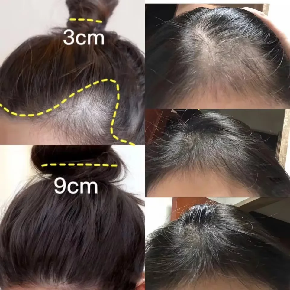 Creme rápido de crescimento ca - Hair Care Dupes avaliação e preço