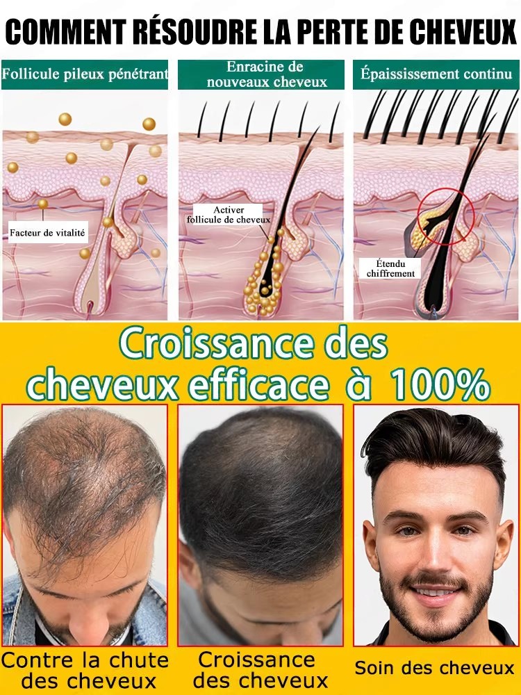 Sérum antiqueda e crescimento  - Hair Care For Hair Fall avaliação e preço